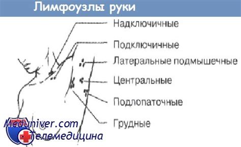 Аксиллярные лимфатические узлы уплотнены