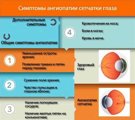 Ангиопатия сосудов сетчатки обоих глаз: причины, симптомы, лечение