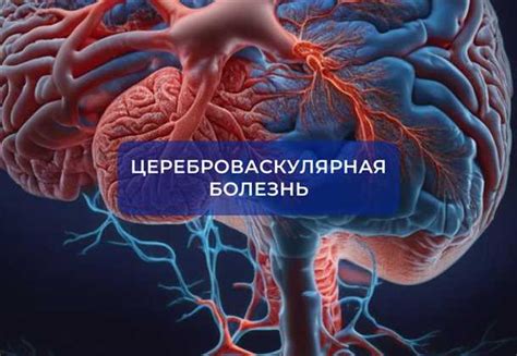 Аномалии сосудов головного мозга