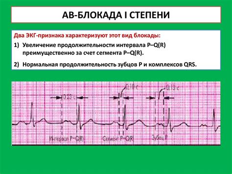 Аномальная ЭКГ: причины, симптомы, лечение