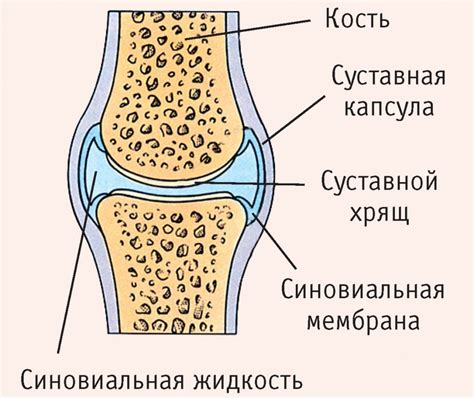 Артрит как причина скопления жидкости в коленном суставе