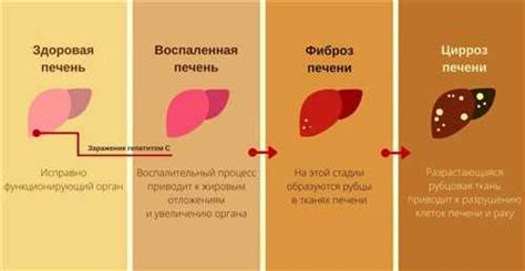 Аnti hcv: обнаружение антител в крови - что это значит?