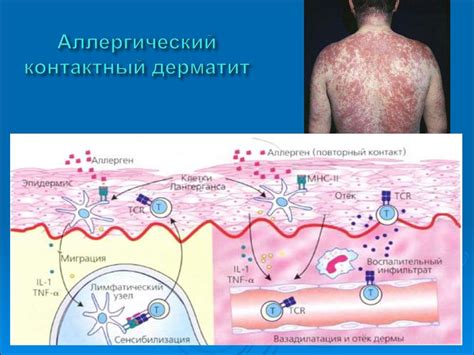 Биологическая совместимость и аллергические реакции