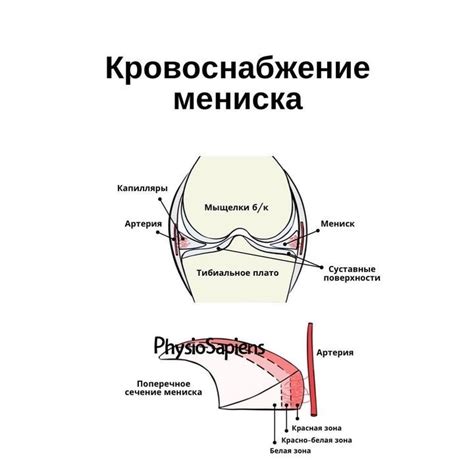 Болевые ощущения при повреждении мениска