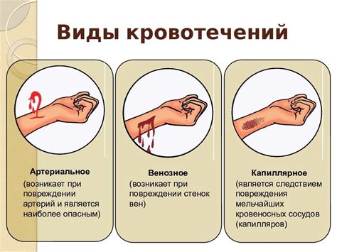 Важность дезинфекции и остановка кровотечения