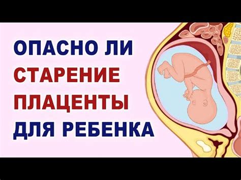 Важность зрелости плаценты для беременности