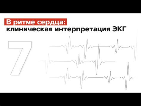 Важность правильной проверки ЭКГ