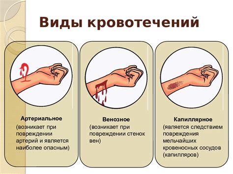 Вероятность кровотечений и инфекций