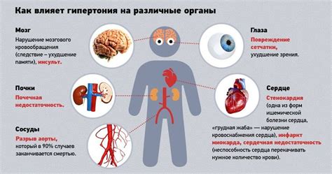 Вестибулярные симптомы гипертонии