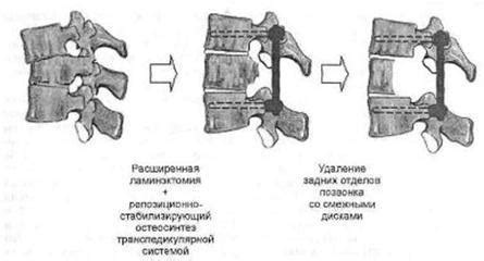 Взаимосвязь сагиттального размера дурального мешка с другими структурами позвоночника