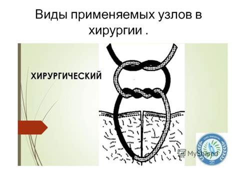 Виды зонтов, применяемых в хирургии