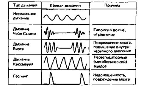 Виды канюль для дыхания