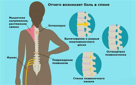 Виды мануальной терапии при болях в спине