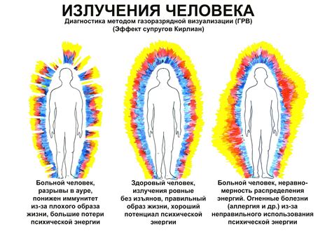 Влияние ауры на приступы