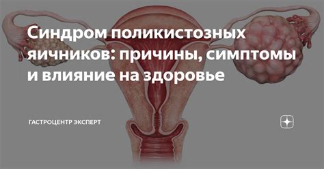 Влияние воспаления яичников на организм