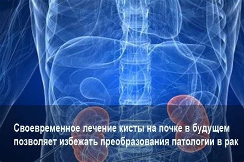 Влияние диеты на кисту на почке