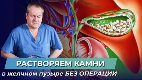 Влияние камня в желчном пузыре на организм