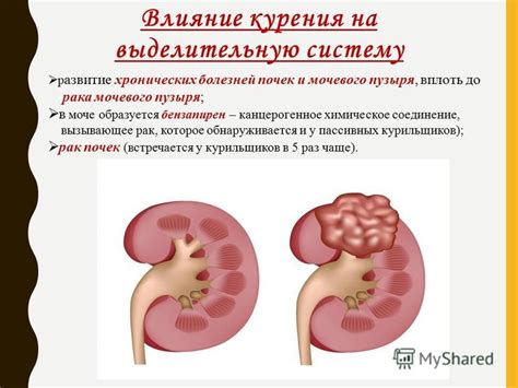 Влияние клоаки на выделительную систему