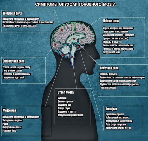 Влияние опухоли головного мозга на организм: причины и последствия