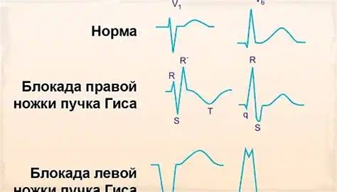 Влияние отклонения ЭОС вправо на здоровье