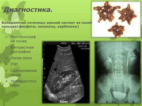 Влияние питания на оксалаты в моче