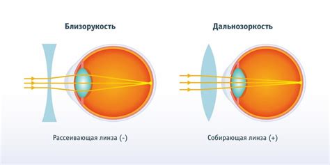 Влияние плюс и минус линз на глаза