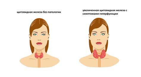 Влияние удаления щитовидной железы на уровень ТТГ