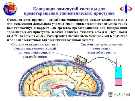 Влияние эпилептических приступов на работу мозга