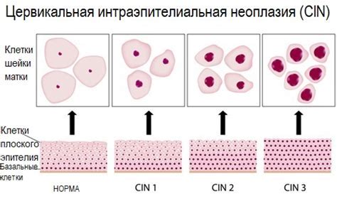 Влияние эпителия плоского на организм