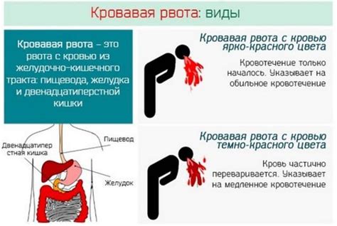 Внешние причины рвоты с кровью