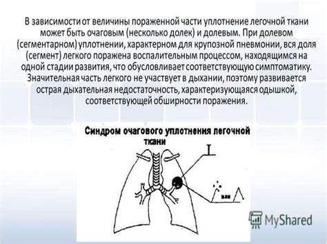 Воздействие внешних агентов на увеличение проницаемости легочной ткани