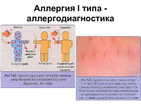 Возможное возникновение аллергических реакций