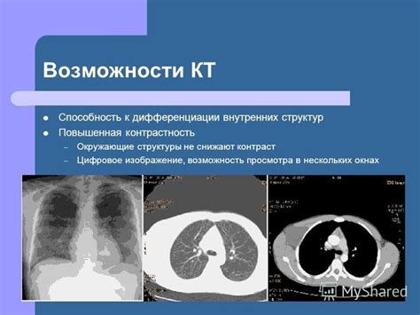 Возможности КТ-сканирования