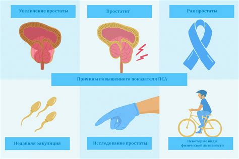 Возможные заболевания, вызывающие повышенный общий пса у мужчин