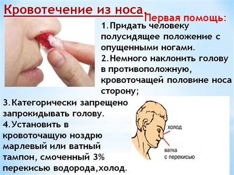 Возможные причины кровотечения из носа