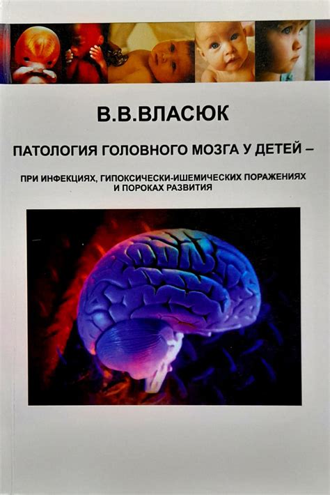 Возможные причины развития лейкопатии головного мозга у детей