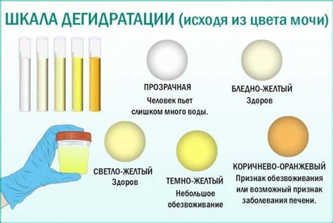 Возможные проблемы при выборе желтого цвета у ребенка