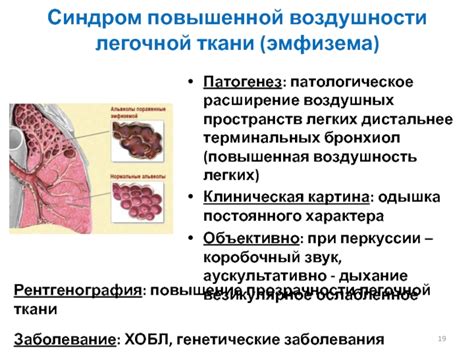 Возникновение повышенной прозрачности легочной ткани