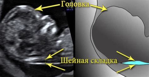 Воротниковая зона у плода