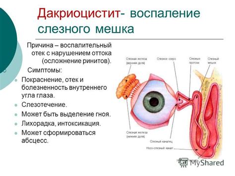 Воспаление, боль, выделение гноя