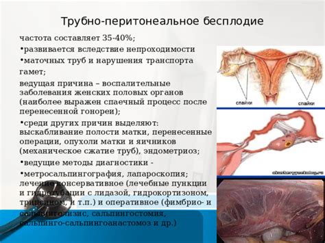 Воспалительные заболевания как причина обильных выделений