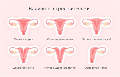 Восстановление размера матки