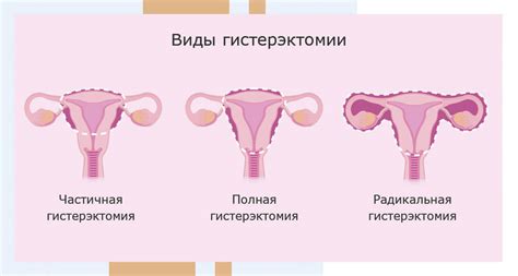 Восстановление эластичности матки