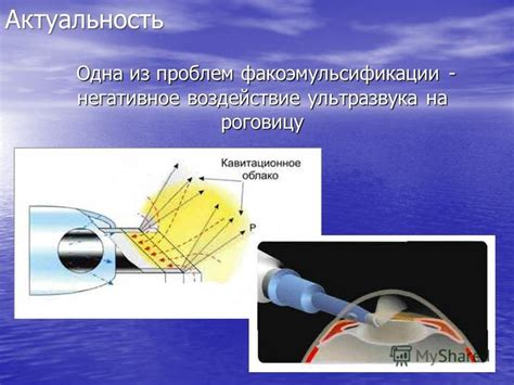 Вредное воздействие на роговицу