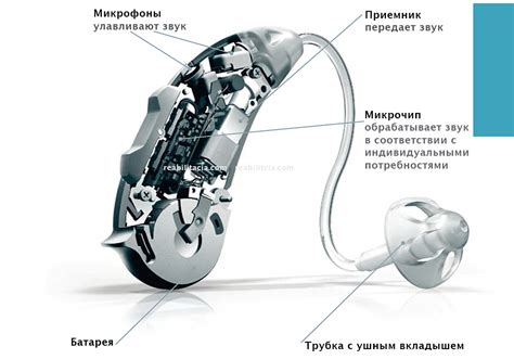 Врожденные аномалии слухового аппарата