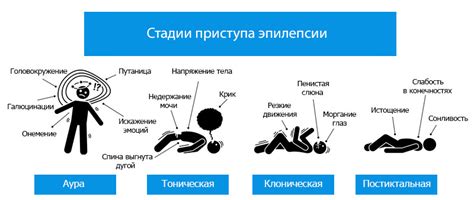 Выявление симптомов эпилепсии или других судорожных состояний