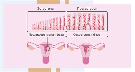 Гиперплазия эндометрия: возможные причины и симптомы