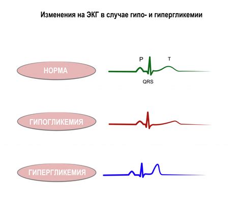 Гипокалиемия: определение и причины развития