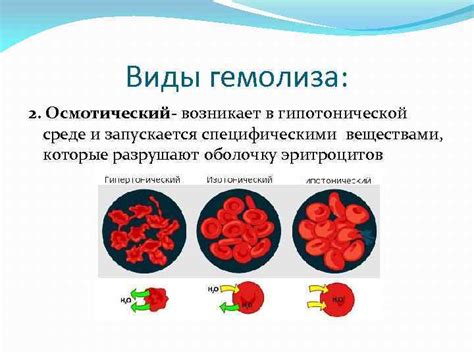 Главные причины гемолиза крови у женщин