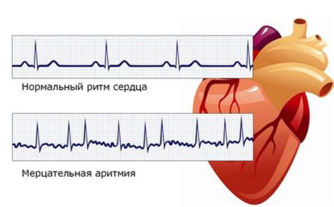 Главные симптомы синусовой аритмии с ЧСС (частота сердечных сокращений)